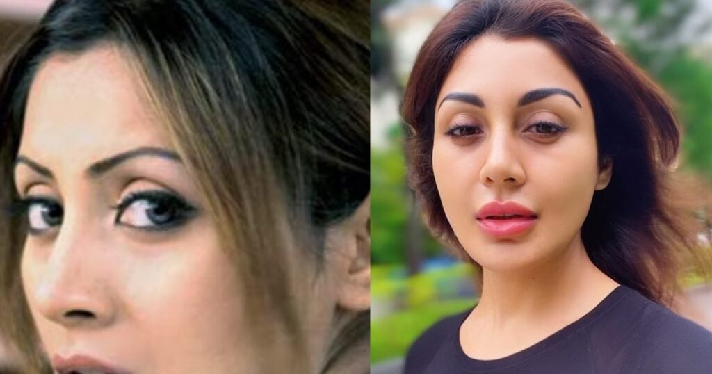 This actress ruled Bollywood for 10 years, went missing in 2016, now difficult to recognize, did she undergo plastic surgery?