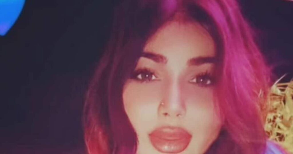 Ayesha Takia got plastic surgery done again? Users trolled her after seeing her latest photos, said- ‘What have you done?’