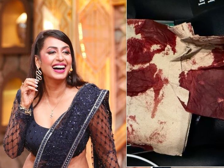 Kashmira Shah met with a road accident, shared picture after accident and said Thank u god for saving me. Such a freak accident. , Kashmira Shah had a major road accident: She showed the blood stained napkin and said – something big was about to happen, but it happened in a small one, Krishna Abhishek reacted