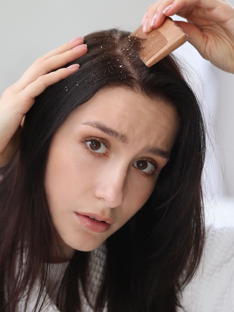 Dandruff will get rid of this oil