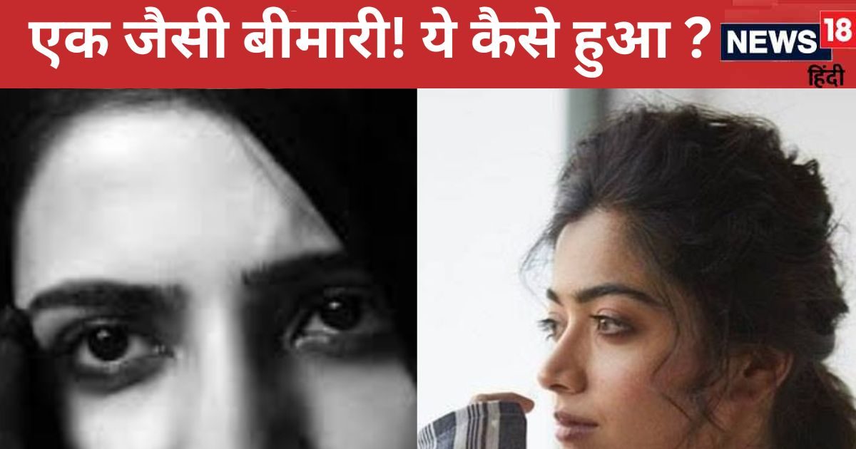 Like Samantha, Rashmika Mandanna also has the same disease! What did the doctors say?