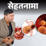 Pancreatic Cancer Symptoms (Treatment - Risk Factors) | Sehatnama- Pancreatic cancer is increasing in Indian men: What are its symptoms, treatment and prevention measures, 10 important advice of the doctor