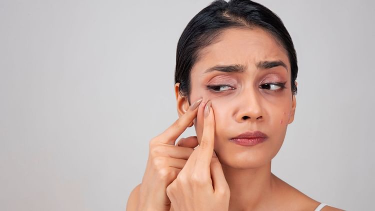 Skin Care Tips in Hindi: What to do if you get pimples on your face due to makeup - Amar Ujala Hindi News Live