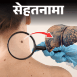 Thick Neck Disease Symptoms; Red Black Moles | Belly Fat Health Issues | Health Naama - The body gestures from head to toe: Know from the doctor that thick neck, red-black warts, growing belly are signs of which disease?